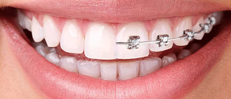 Orthodontist in Coimbatore